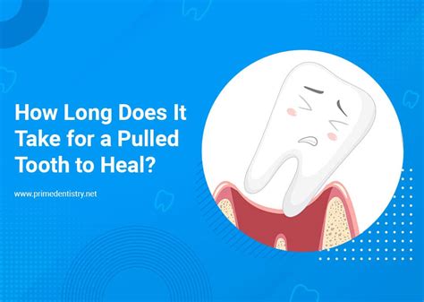 How To Pull A Tooth