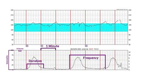 How To Read Contraction Monitor