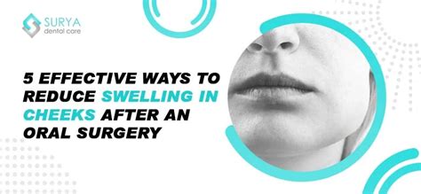 How To Reduce Swelling In The Face After Surgery