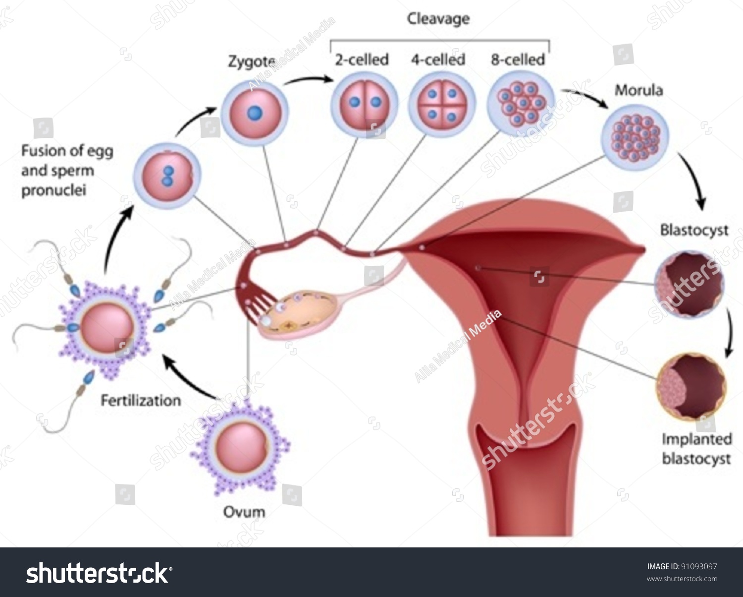 Implantation Bleeding Pics