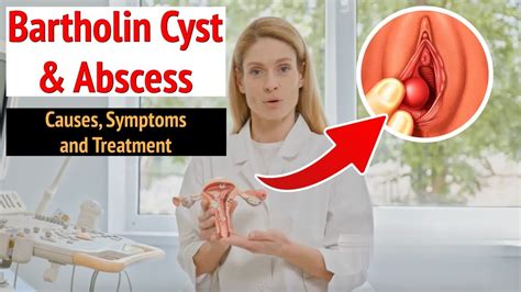 Is Bartholin Cyst Dangerous