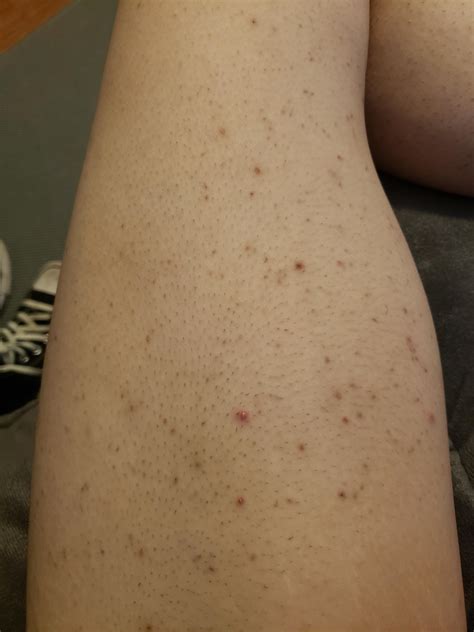 Is It Normal To Itch After Shaving