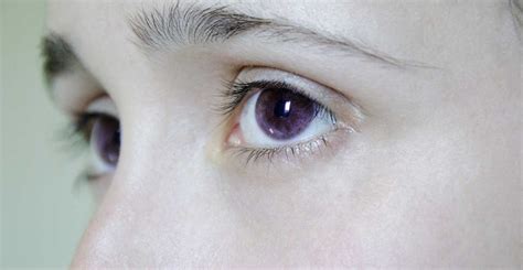 Is It Possible To Have Purple Eyes