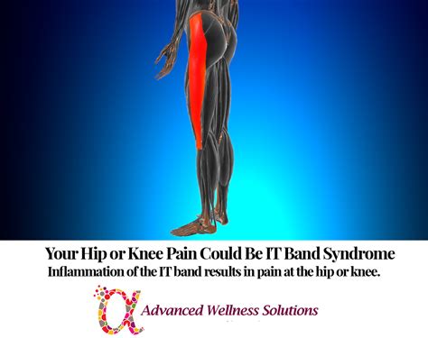 It Band Hip Pain