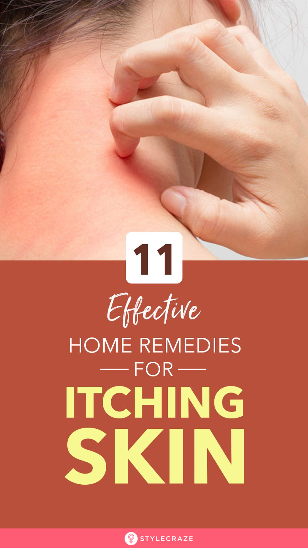 Itching At Foot