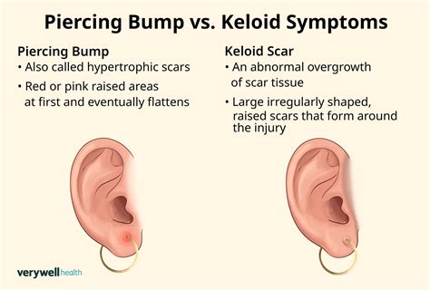 Keloid Scar Piercing