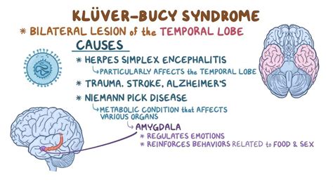 Kluver Bucy Syndrome