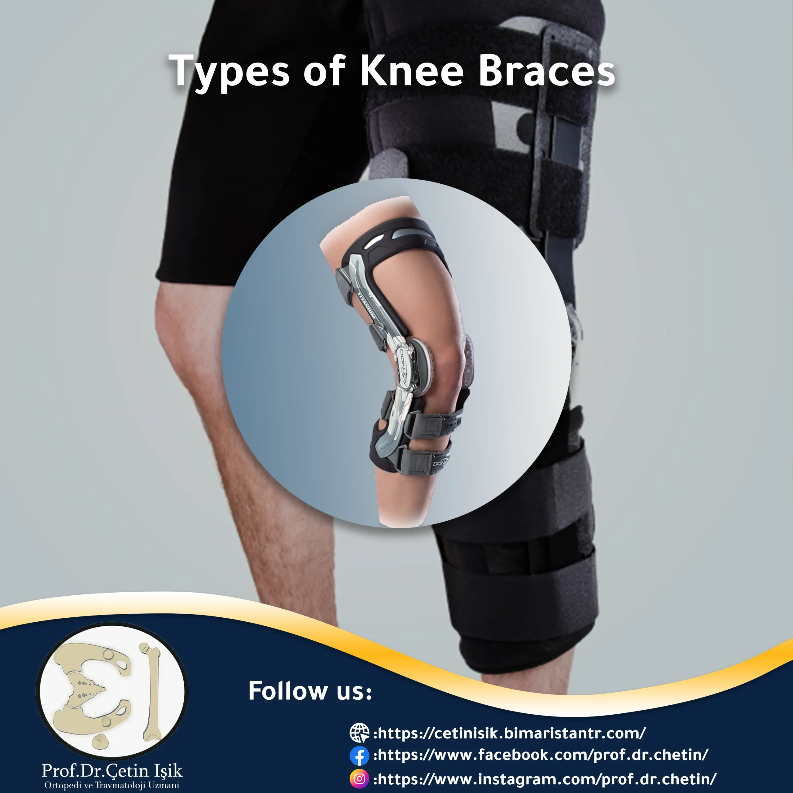 Knee Joint Cartilage