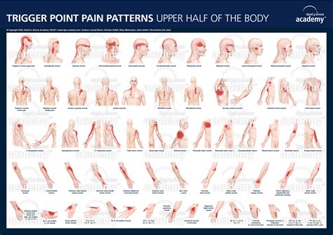 Latis Trigger Point