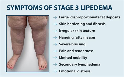 Lipedema Or Just Fat Legs