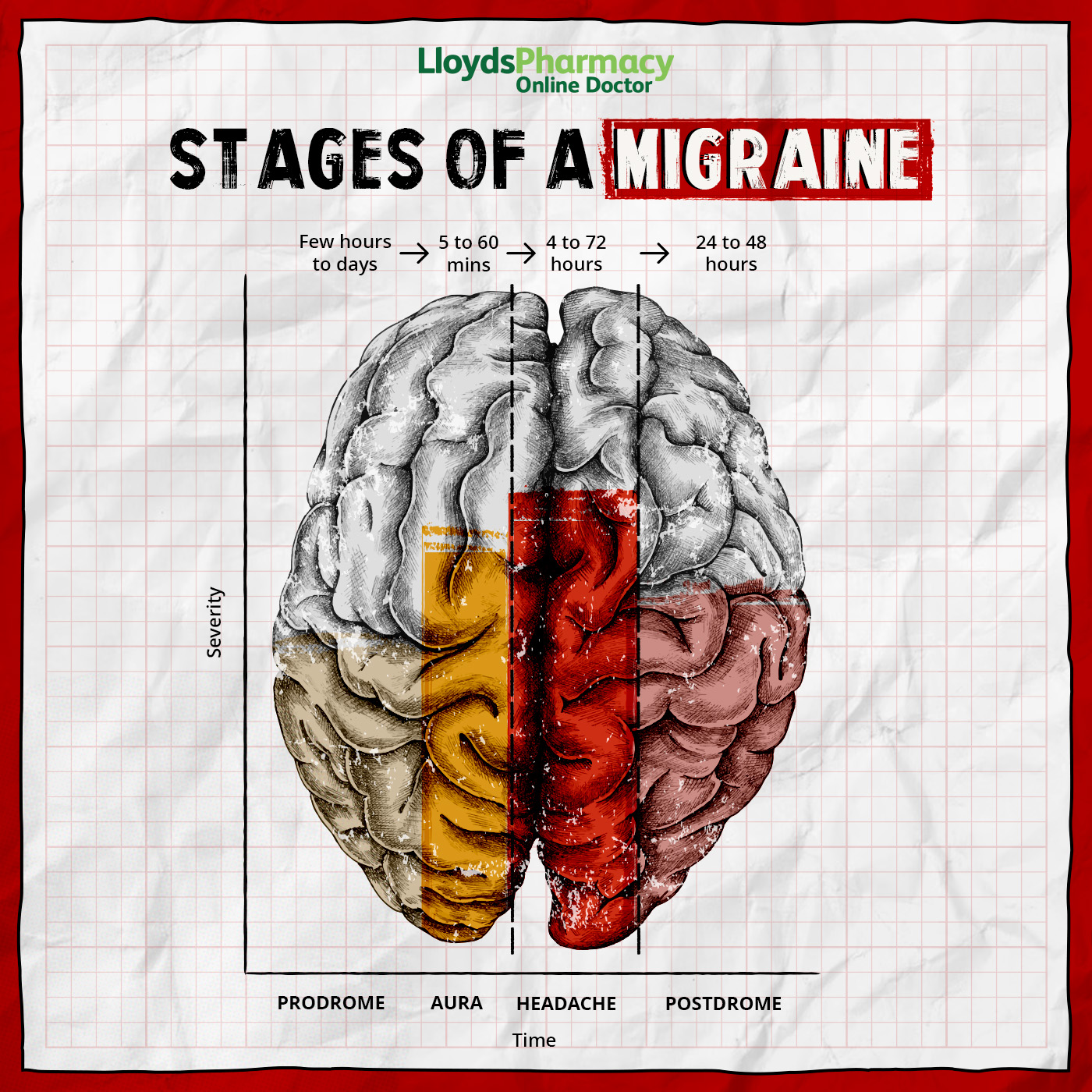 Migraine Neck Pain
