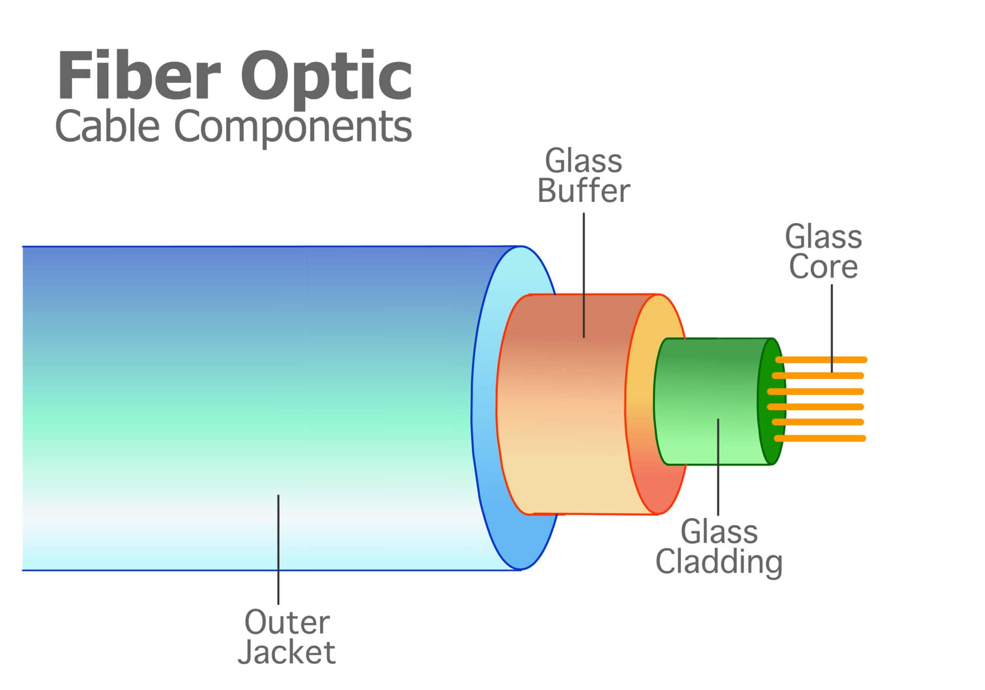 Optic Nerve Drusen