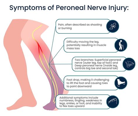 Peroneal Nerve Injury