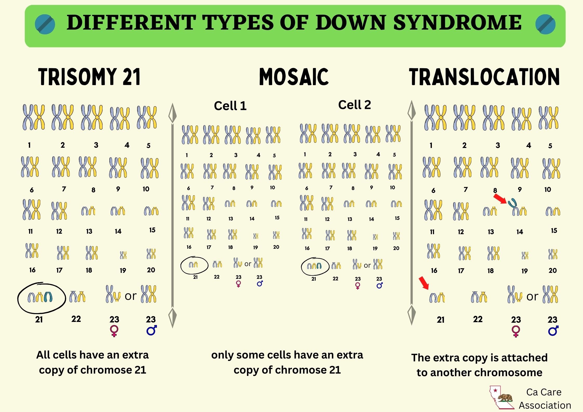 Understanding The Physical Characteristics Of Mosaic Down Syndrome