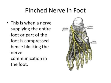 Pinched Nerve In Foot