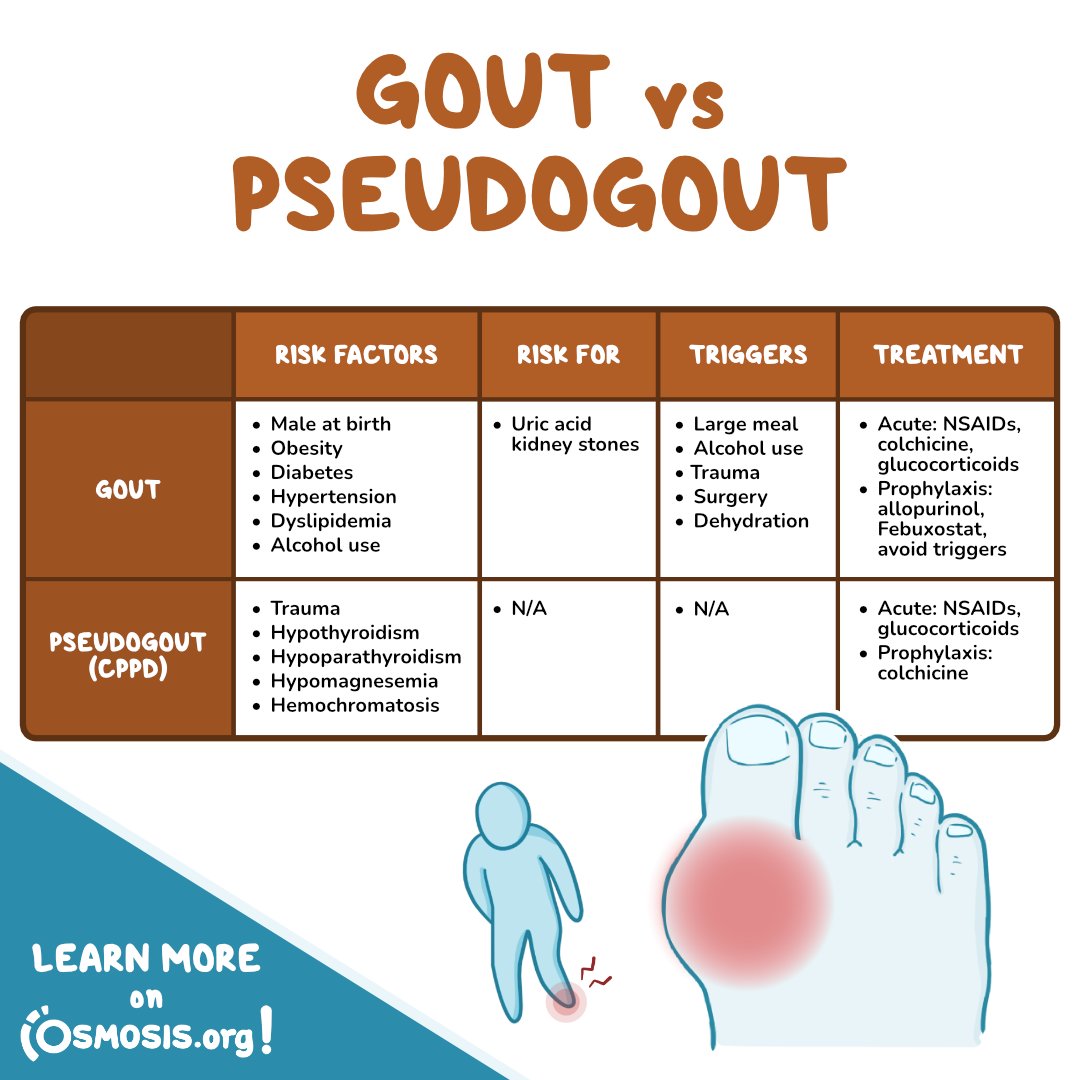 Pseudo Jones Fracture