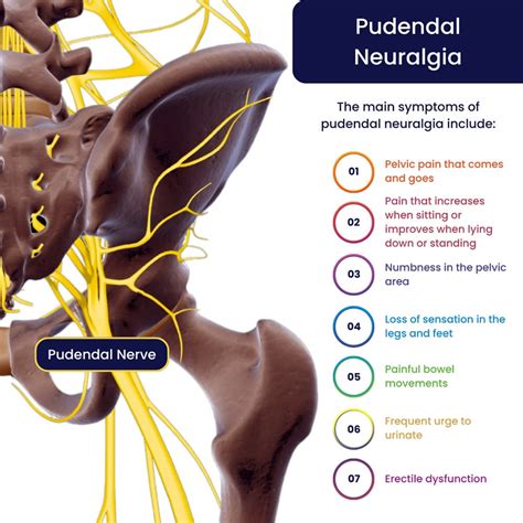Pudendal Neuralgia Curable