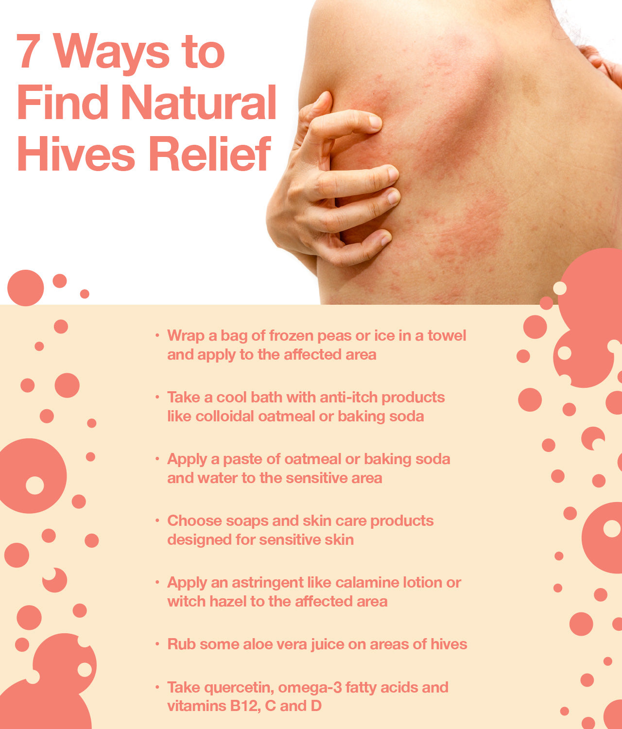 Rash Under Breasts