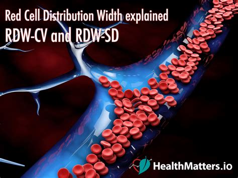 Rdwsd Blood Test High