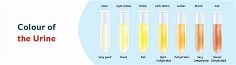 S.g. In Urine
