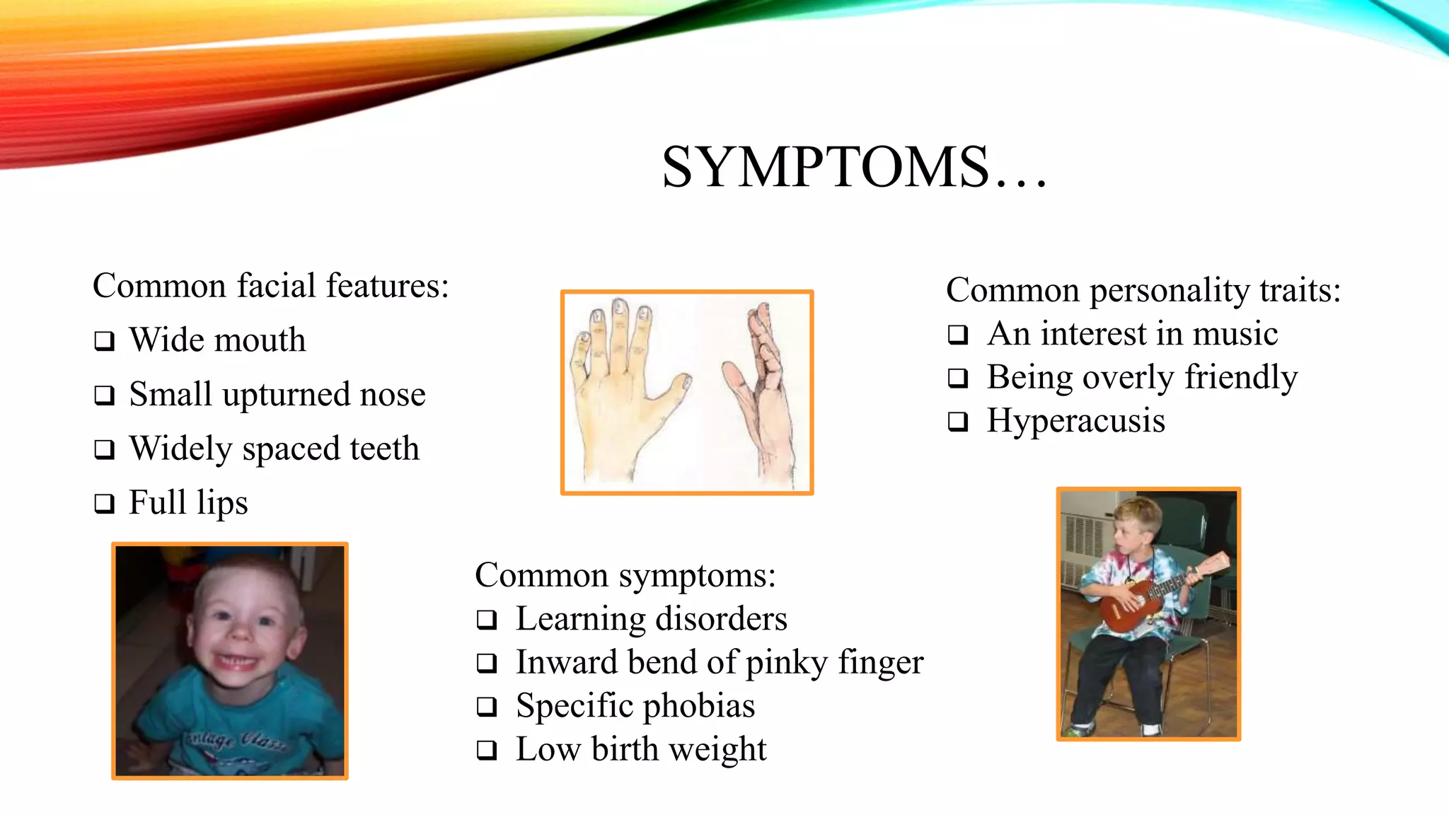 Sindrome Melkersson Rosenthal