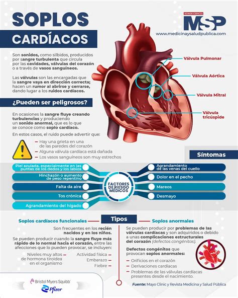 Soplo En En Corazon
