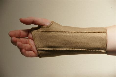 Splinting Carpal Tunnel