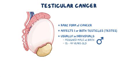 Testis Cancer Photos