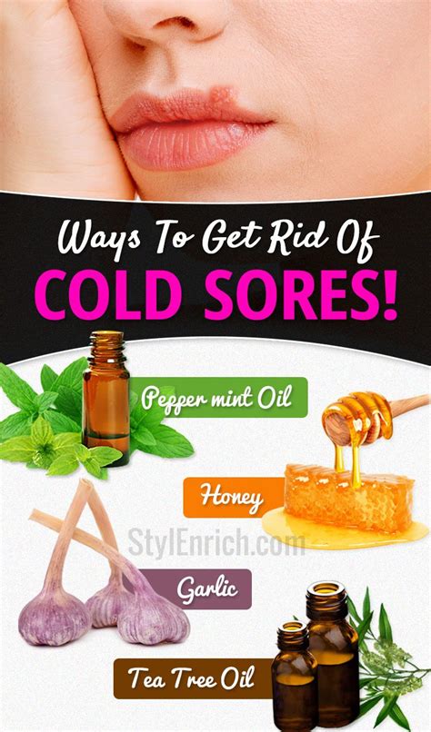 Treat Cold Sores Home Remedies