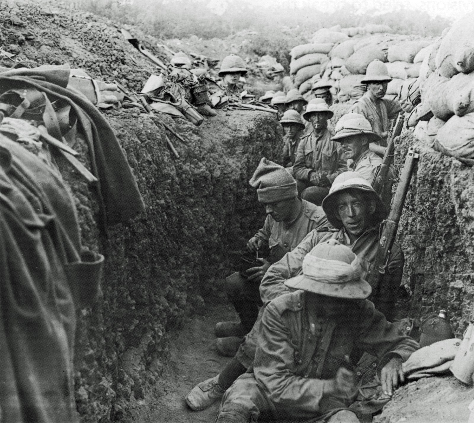 Trench Foot Signs And Symptoms