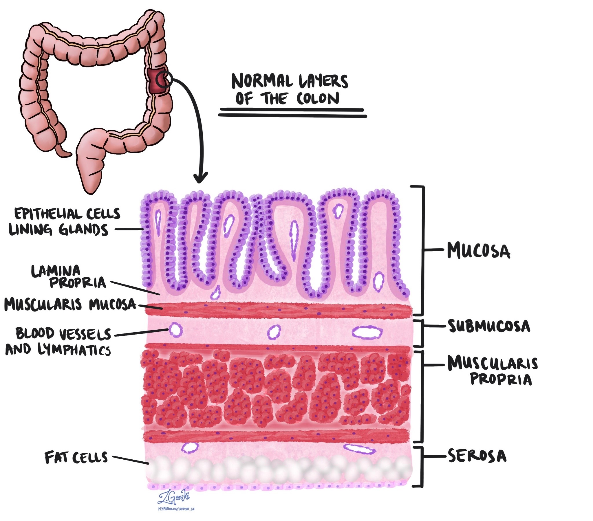 Trigger Point Muscle Therapy