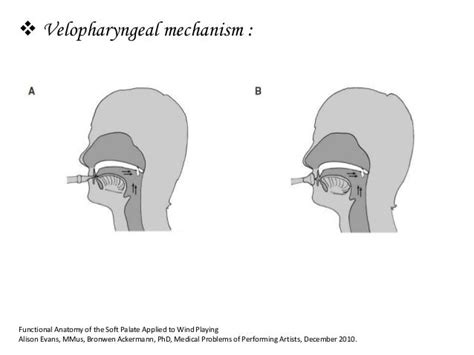 Velar Pharyngeal Insufficiency