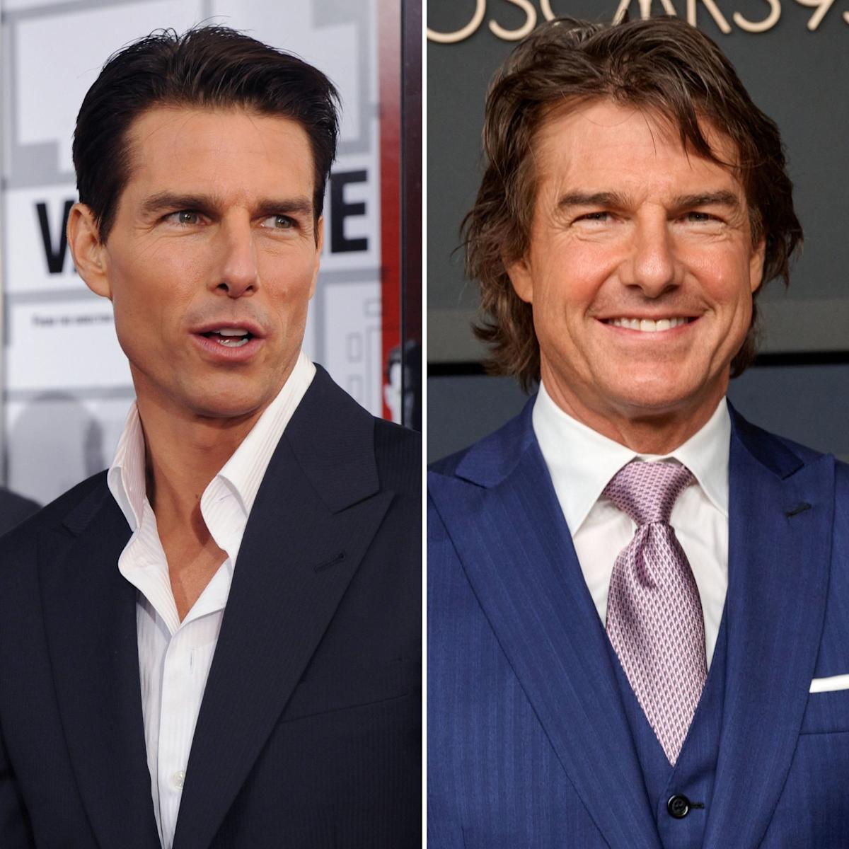Veneers Before And After