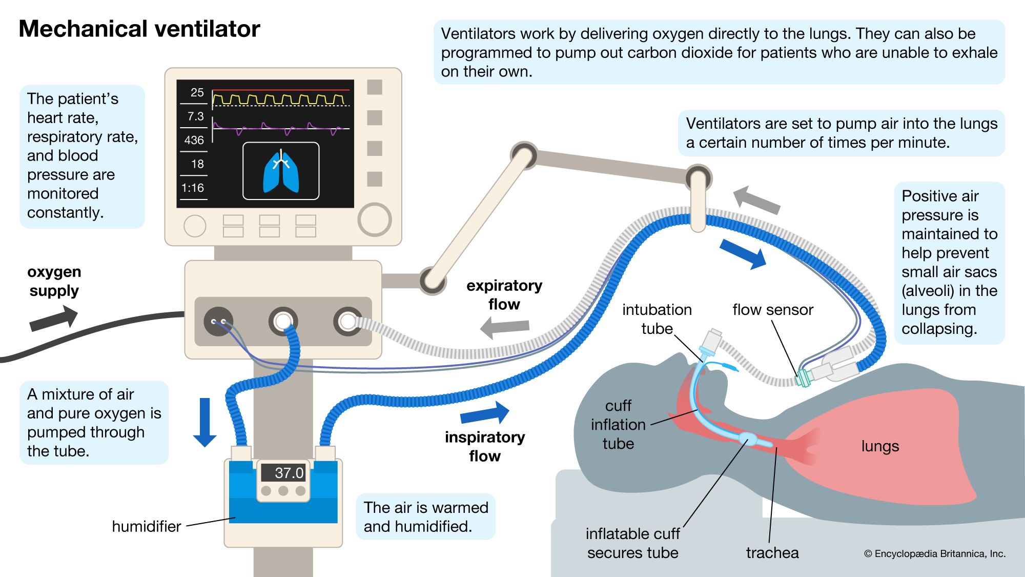 Ventilator Modes
