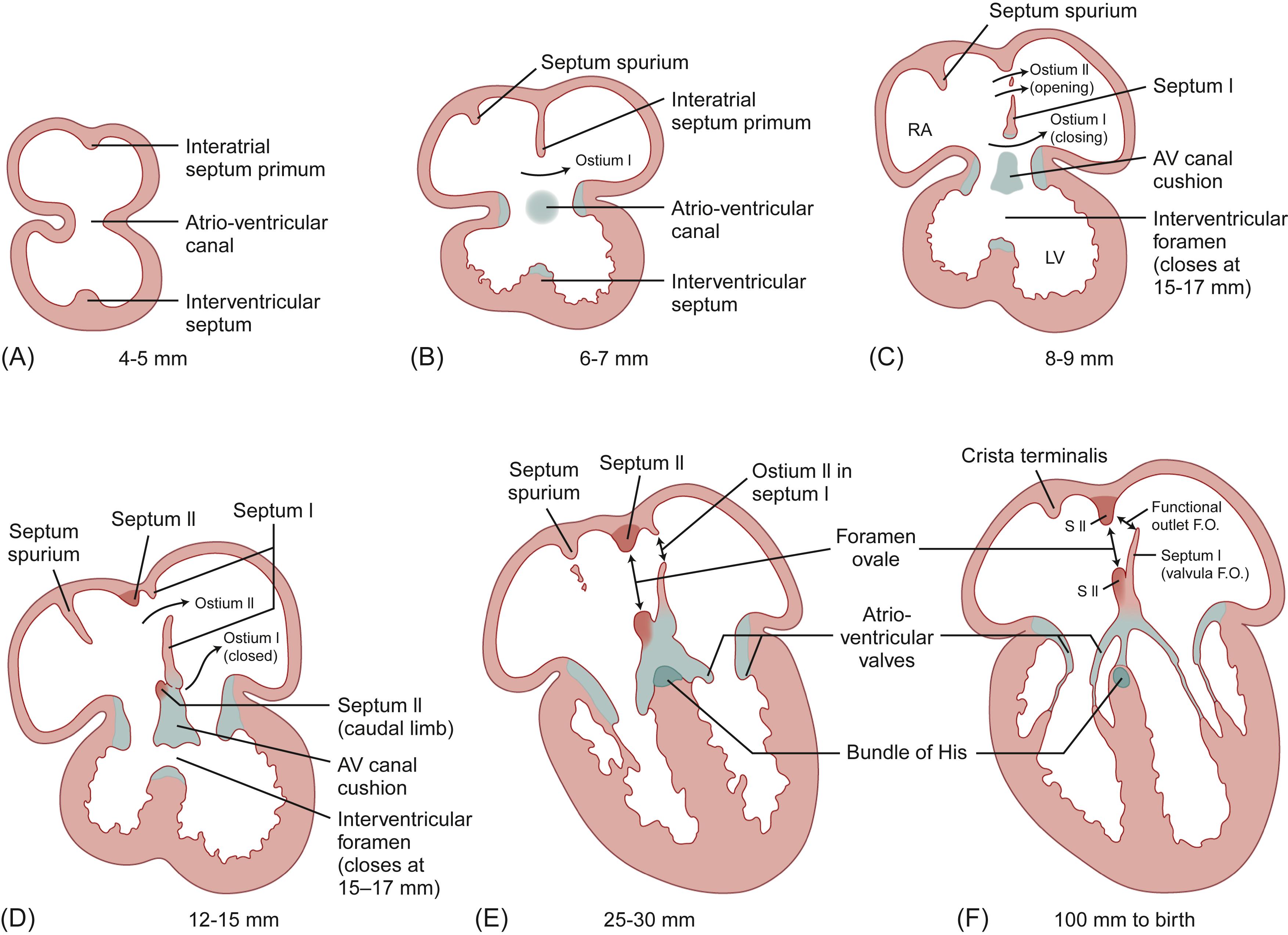 Ventricular Rate