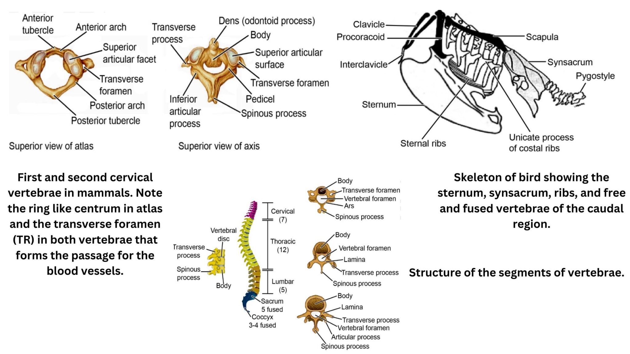 Vertebral Artery Occlusion