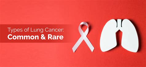What Cancer Is Rare