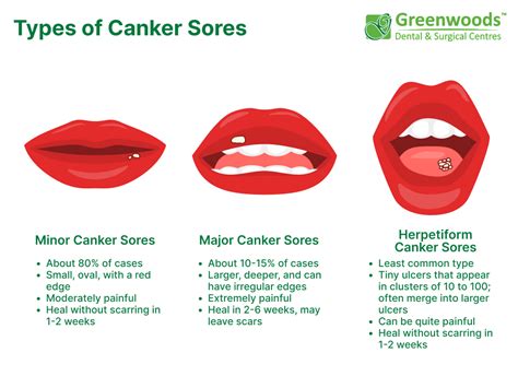What Causes Canker Sores