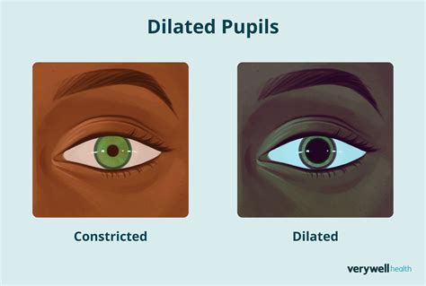 What Causes Dilated Pupils