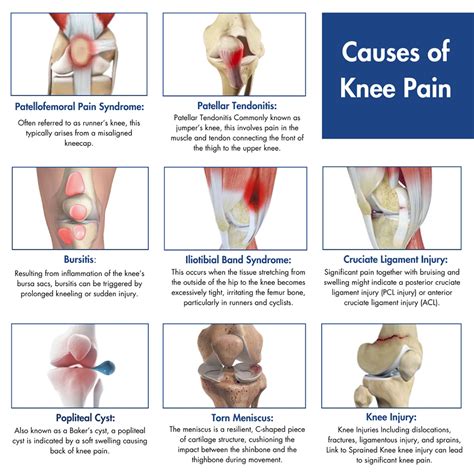 What Causes Knee Pain