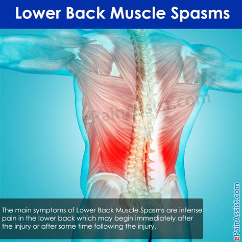 What Causes Lower Back Spasms