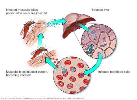 What Causes Malaria