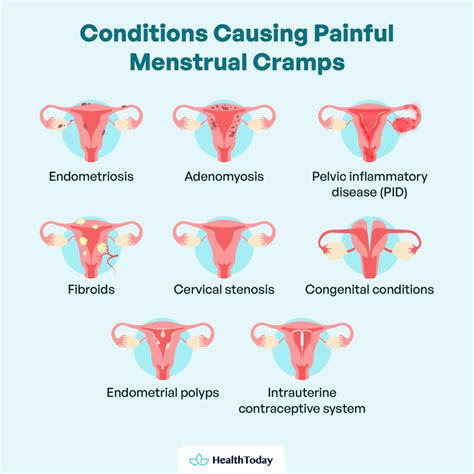 What Causes Period Cramps