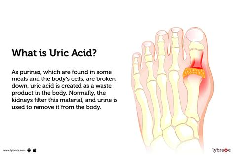 What Causes Uric Acid Build Up