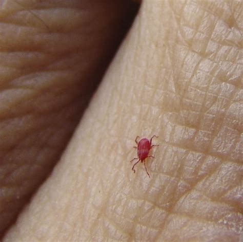 What Cures Red Bugs Chiggers Treatment