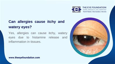 What Cures Watery Eyes