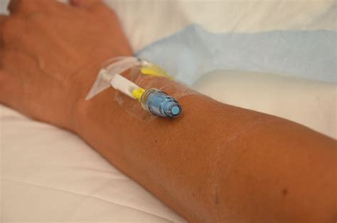 What Does An Iv Do