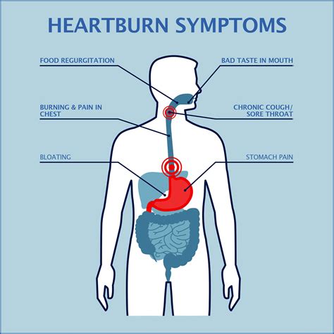 What Does Heartburn Feel Like And Where