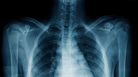 What Does Look Like X Ray