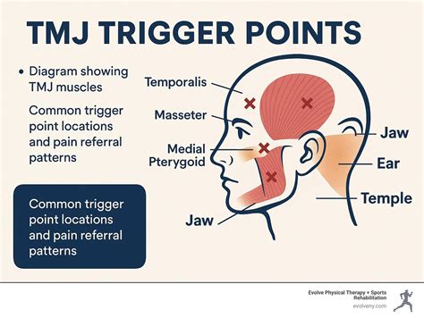 What Happens If Tmj Doesn't Go Away